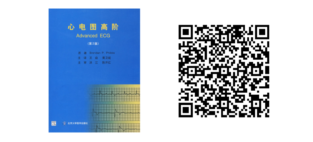 床旁心电图怎么做预售 ｜ 床旁临时心脏起搏手册，手把手教会起搏技术！_https://www.jmylbn.com_新闻资讯_第40张