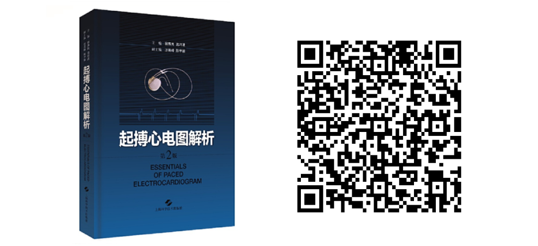 床旁心电图怎么做预售 ｜ 床旁临时心脏起搏手册，手把手教会起搏技术！_https://www.jmylbn.com_新闻资讯_第44张