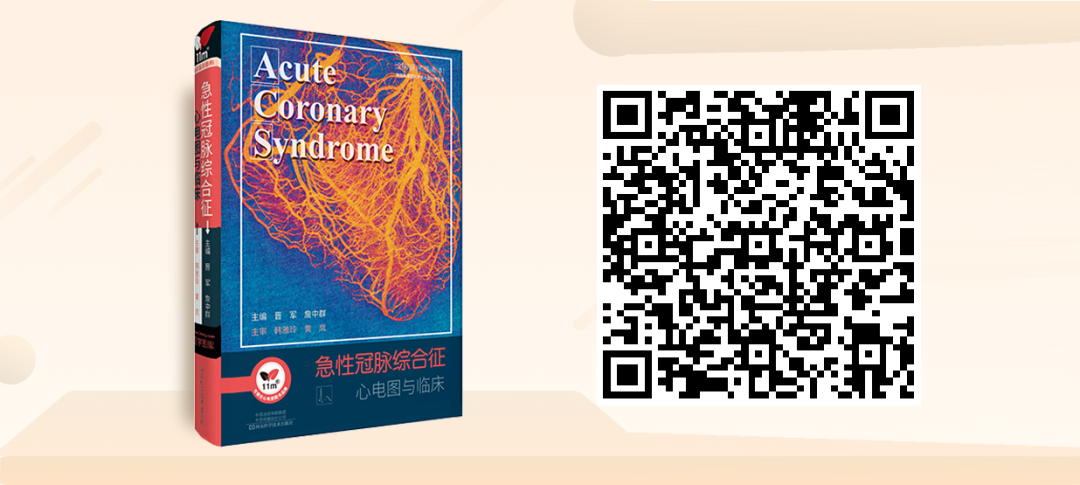 床旁心电图怎么做预售 ｜ 床旁临时心脏起搏手册，手把手教会起搏技术！_https://www.jmylbn.com_新闻资讯_第36张