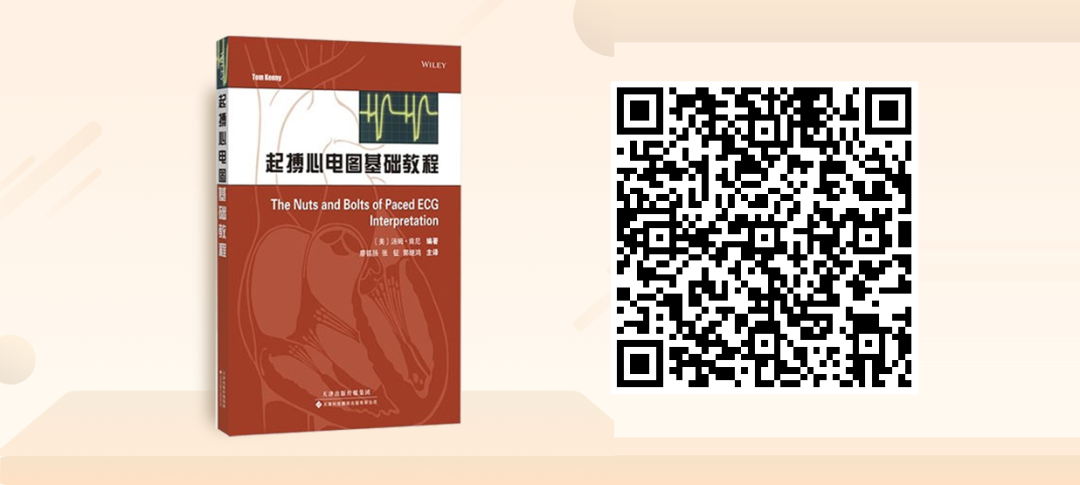 床旁心电图怎么做预售 ｜ 床旁临时心脏起搏手册，手把手教会起搏技术！_https://www.jmylbn.com_新闻资讯_第38张