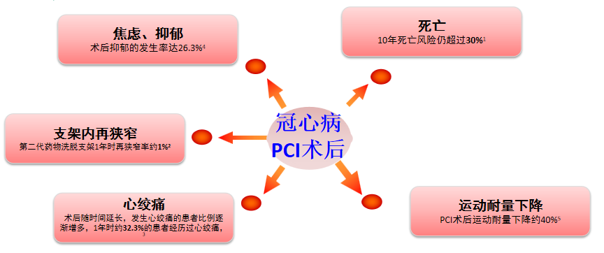 体外反搏在心脏康复中的应用