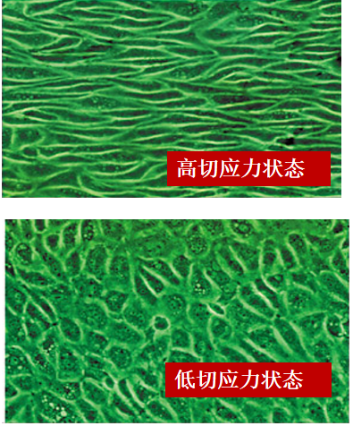 体外反搏在心脏康复中的应用