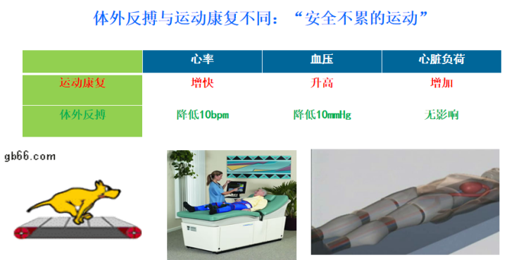 体外反搏在心脏康复中的应用