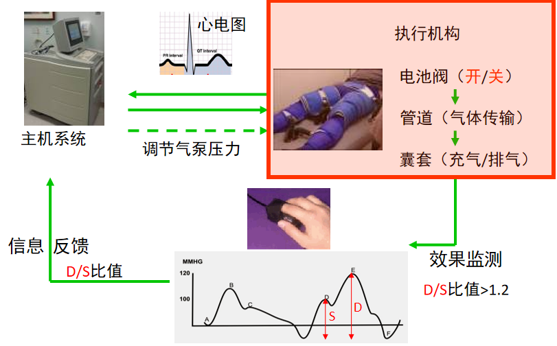 体外反搏在心脏康复中的应用