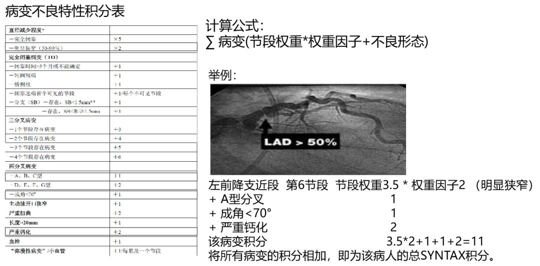 造影导丝是什么珍藏 冠脉造影从流程到诊断，基础必备！_https://www.jmylbn.com_新闻资讯_第101张