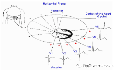 急性心梗的识别与处理！一文总结！