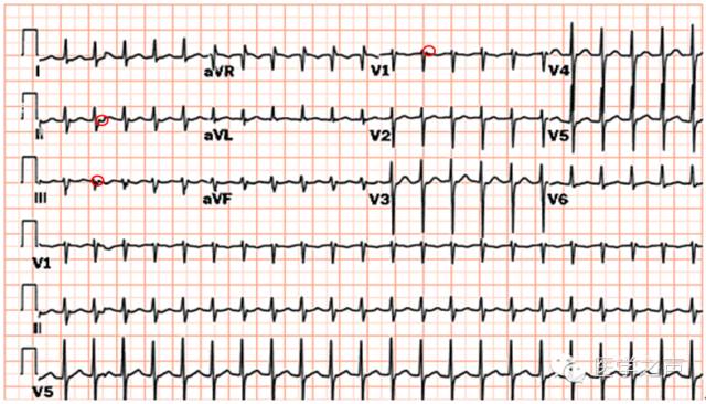 异搏定_京东滔搏是真的滔搏吗_人生能有几回搏 此时不搏何时搏