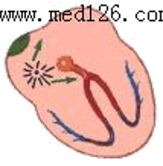 心电图自动分析有哪些心电图识分析六步走_https://www.jmylbn.com_新闻资讯_第10张