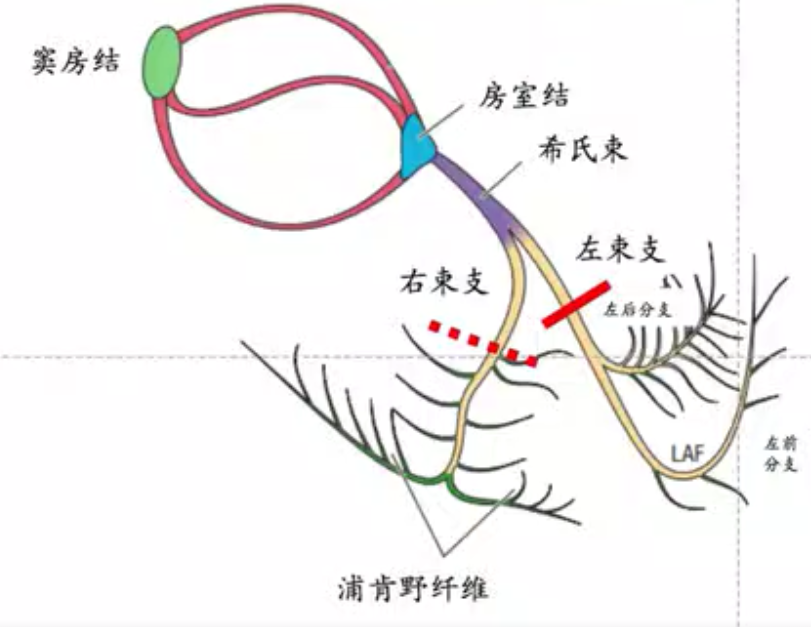 心电图如何判断房室传导阻滞部位收藏这篇轻松get