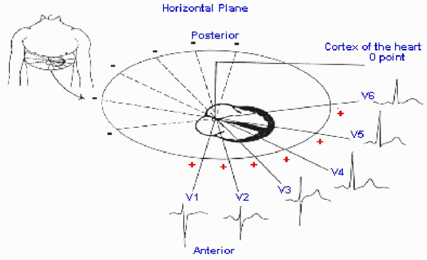 太全了！急性心梗的识别与处理，赶紧存起来