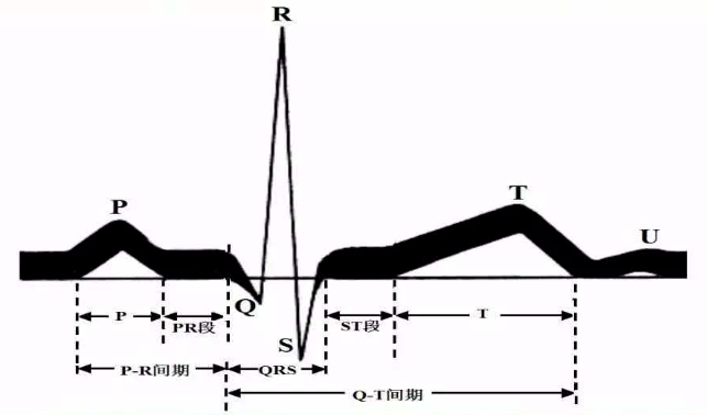 什么是同步心电图心电图学不会、记不住？这个合集very good！_https://www.jmylbn.com_新闻资讯_第6张