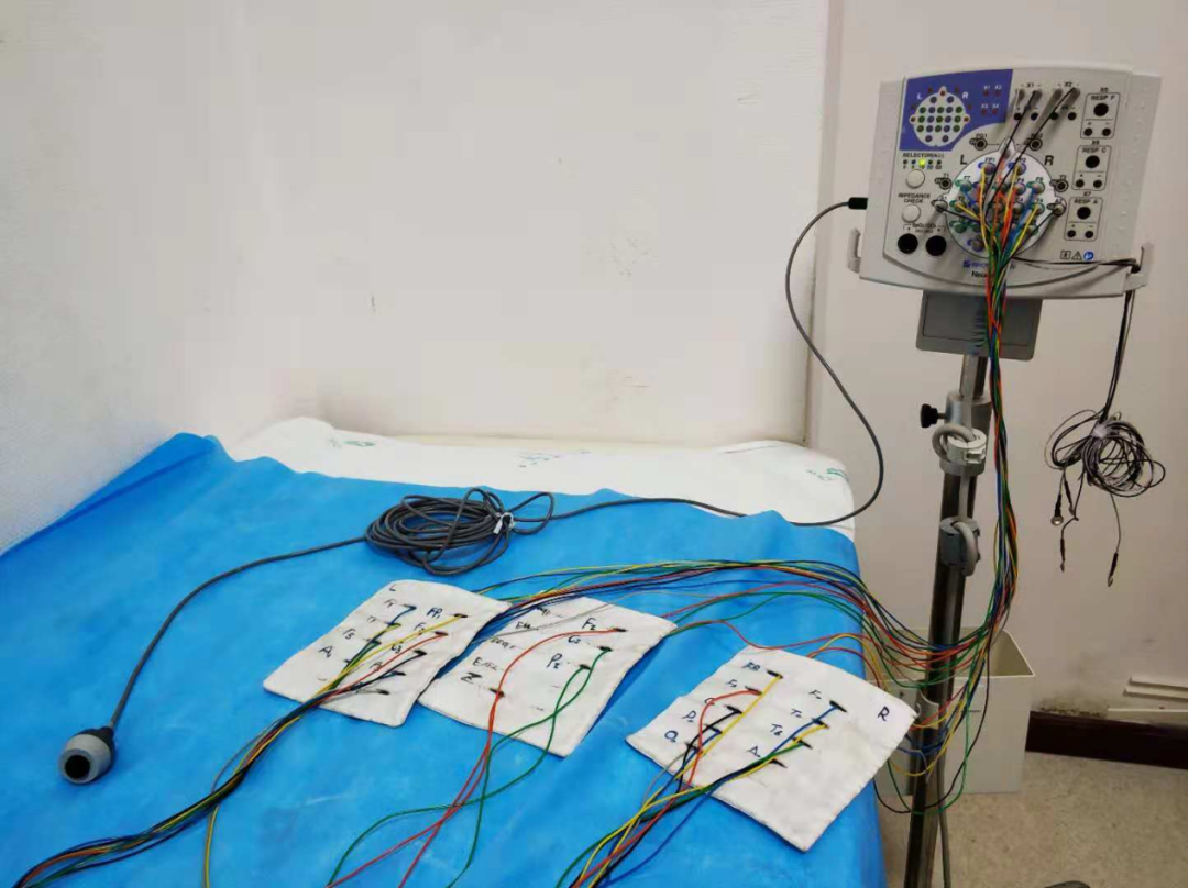 日本光电脑电图怎么样“会说话”的脑电图告诉您为什么宝宝经常四肢抖动_https://www.jmylbn.com_新闻资讯_第7张