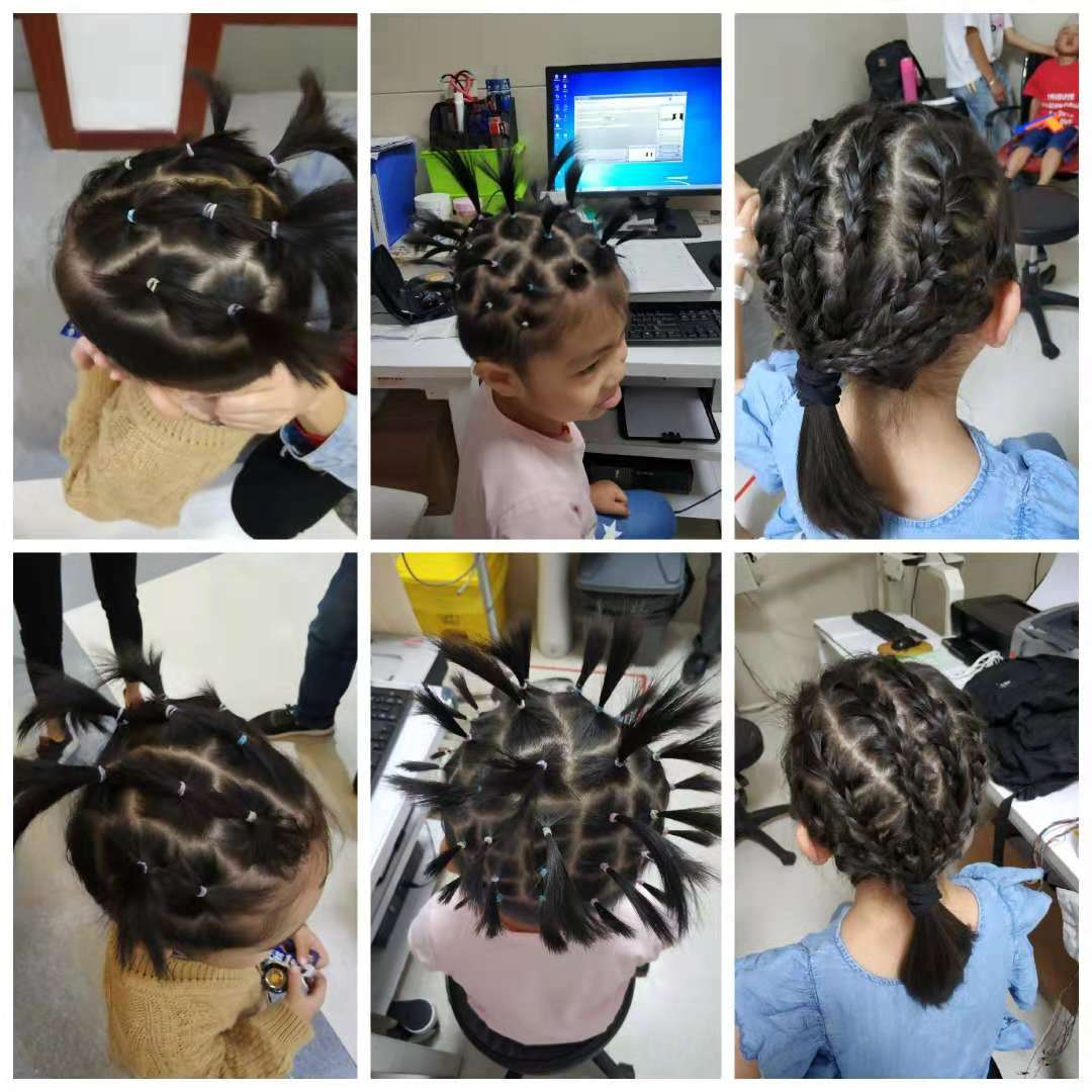 日本光电脑电图怎么样“会说话”的脑电图告诉您为什么宝宝经常四肢抖动_https://www.jmylbn.com_新闻资讯_第13张