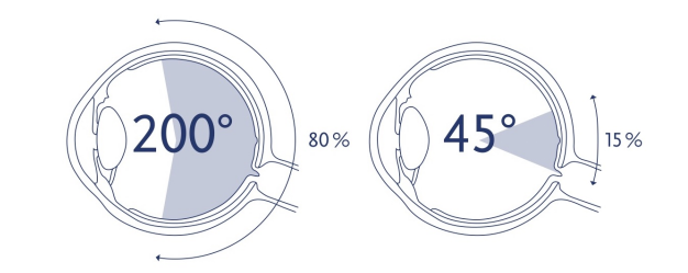 怎么看眼底相机世界睛彩 尽收眼底——你不知道的神奇“眼底照相机”_https://www.jmylbn.com_新闻资讯_第2张
