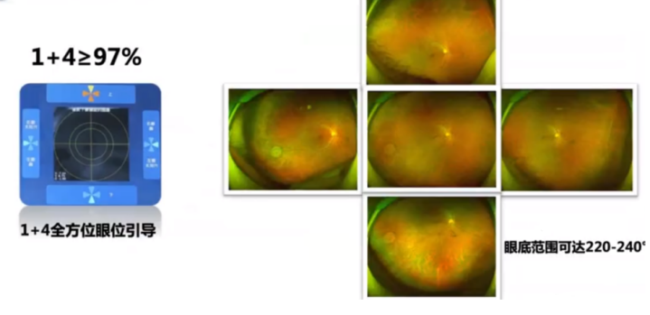怎么看眼底相机世界睛彩 尽收眼底——你不知道的神奇“眼底照相机”_https://www.jmylbn.com_新闻资讯_第3张