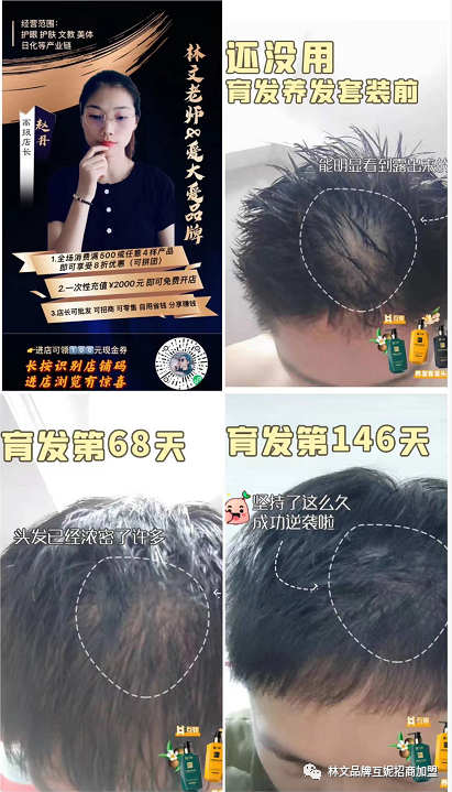 换了很多洗头的头发还是脱，还是白发怎么办？