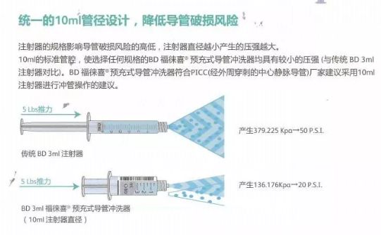 预充式导管冲洗器是什么预充式导管冲洗器-福徕喜_https://www.jmylbn.com_新闻资讯_第4张