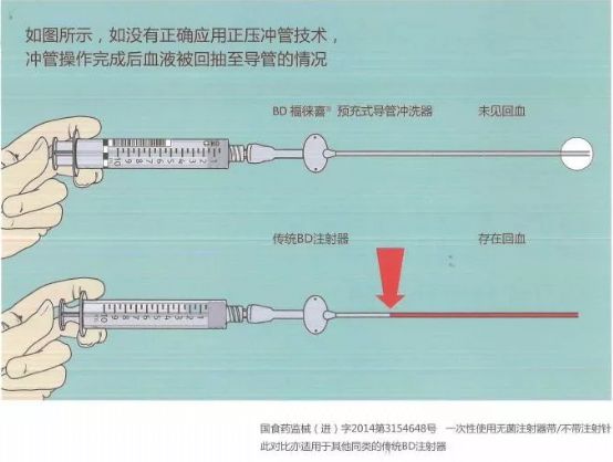 预充式导管冲洗器是什么预充式导管冲洗器-福徕喜_https://www.jmylbn.com_新闻资讯_第2张