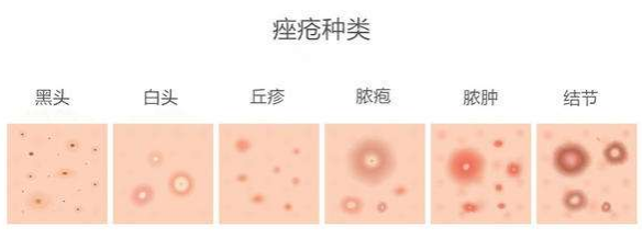 皮肤疾病是“小病”？！当心小病成大病~~~