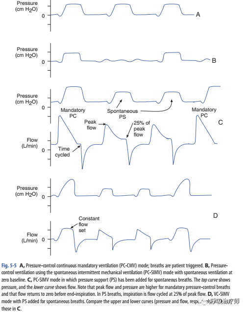 呼吸机ac是什么意思呼吸机模式——P-A／C ,V-A／C_https://www.jmylbn.com_新闻资讯_第2张