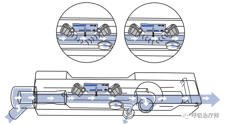 呼吸机pip是什么意思呼吸功能监测-呼吸力学监测_https://www.jmylbn.com_新闻资讯_第2张