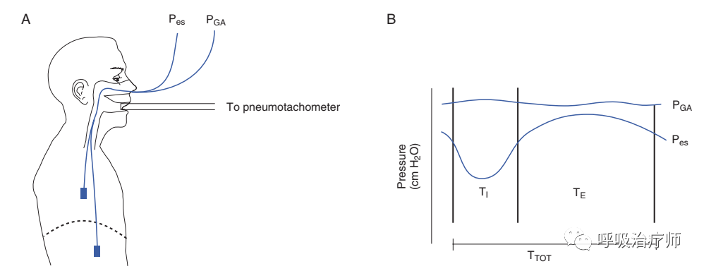 呼吸机pip是什么意思呼吸功能监测-呼吸力学监测_https://www.jmylbn.com_新闻资讯_第9张