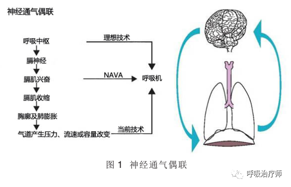 呼吸机模式怎么调节呼吸机模式-NAVA／MMV_https://www.jmylbn.com_新闻资讯_第1张
