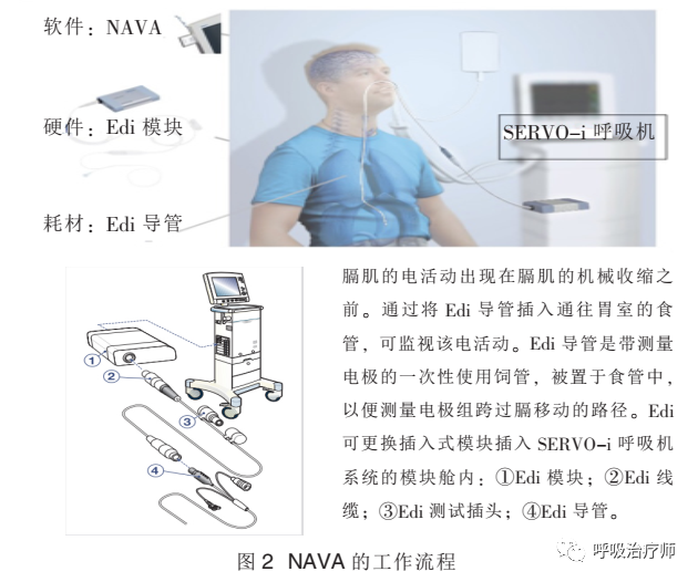 呼吸机模式怎么调节呼吸机模式-NAVA／MMV_https://www.jmylbn.com_新闻资讯_第2张