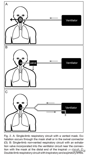 怎么按面罩不漏气文献解读-无创正压通气时面罩的选择（续）_https://www.jmylbn.com_新闻资讯_第1张
