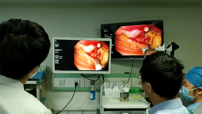 德国胃镜有什么牌子【蔡医科普】做胃镜有风险吗？多久做一次合适？_https://www.jmylbn.com_新闻资讯_第2张