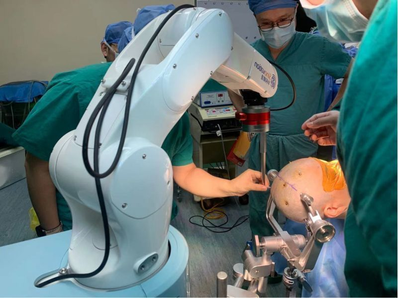 手术床怎么准备手术配合 ｜ 宁波市第一医院——机器人辅助立体定向脑组织穿刺活检术手术配合与管理_https://www.jmylbn.com_新闻资讯_第7张