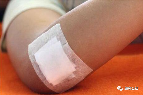 人工敷料怎么照顾伤口伤口分类及护理原则（五）：敷料的选择和选分类_https://www.jmylbn.com_新闻资讯_第13张