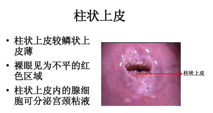 宫颈刷什么材质宫颈糜烂不是病，但是一个警示信号-上海聚慕医疗器械有限公司