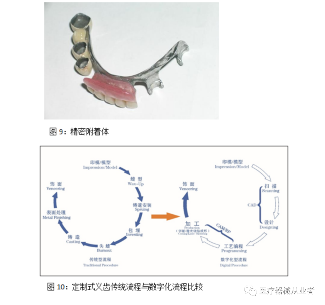 什么是定制式义齿【学习】定制式义齿医疗器械基本常识_https://www.jmylbn.com_新闻资讯_第9张