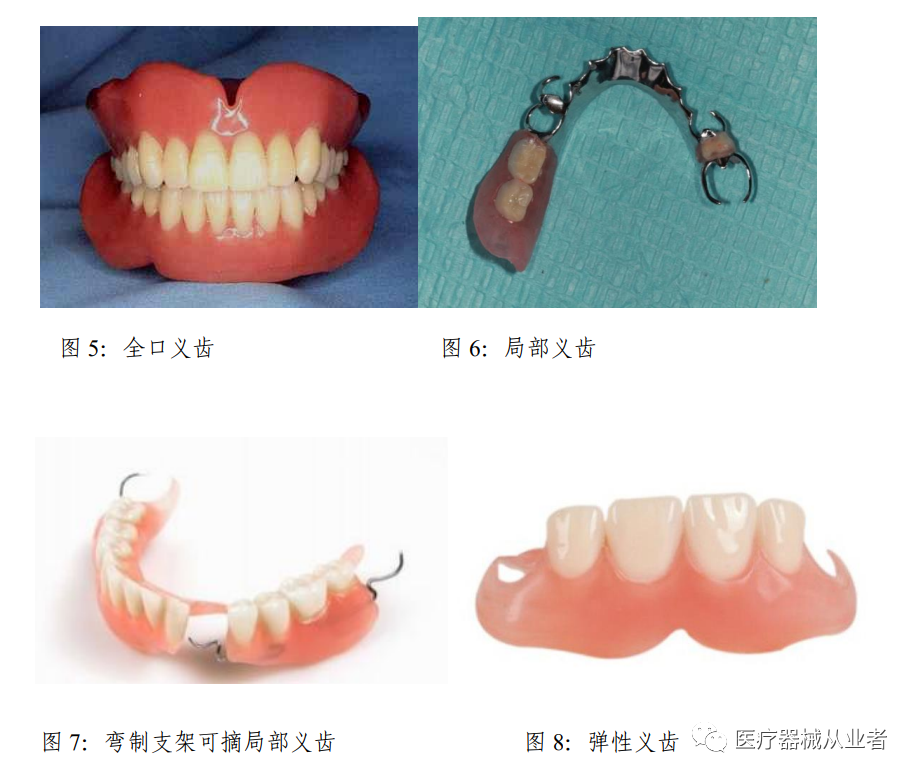什么是定制式义齿【学习】定制式义齿医疗器械基本常识_https://www.jmylbn.com_新闻资讯_第5张