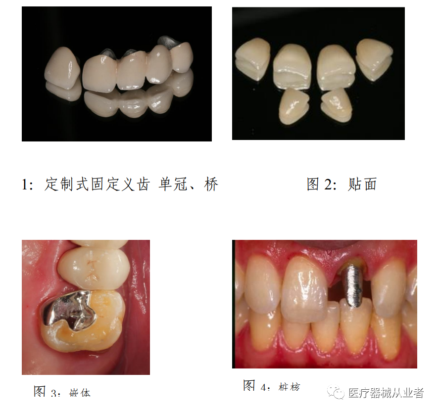 什么是定制式义齿【学习】定制式义齿医疗器械基本常识_https://www.jmylbn.com_新闻资讯_第4张