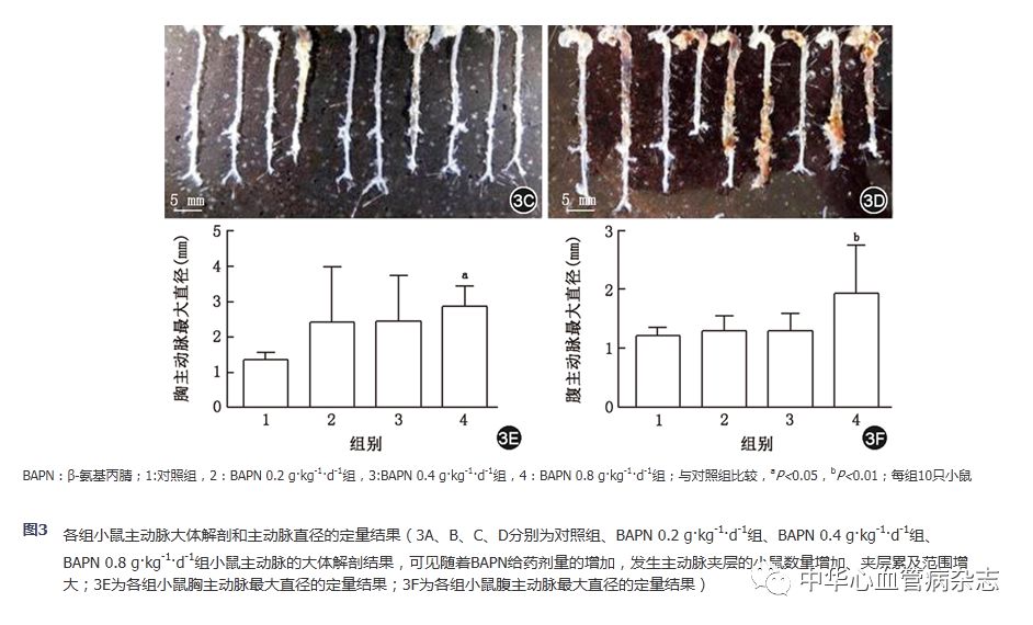 怎么使实验小鼠升血压【基础研究】β-氨基丙腈饮水建立小鼠主动脉夹层模型_https://www.jmylbn.com_新闻资讯_第5张