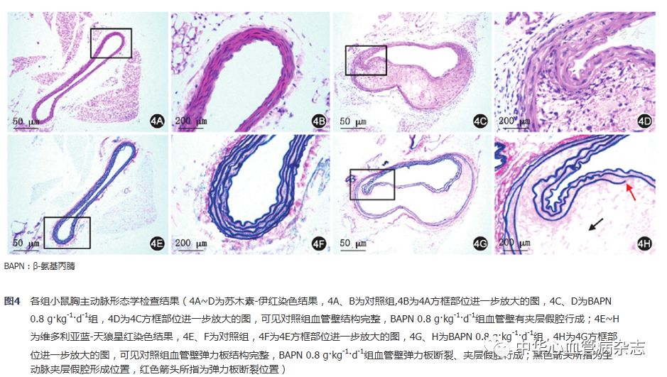 怎么使实验小鼠升血压【基础研究】β-氨基丙腈饮水建立小鼠主动脉夹层模型_https://www.jmylbn.com_新闻资讯_第6张