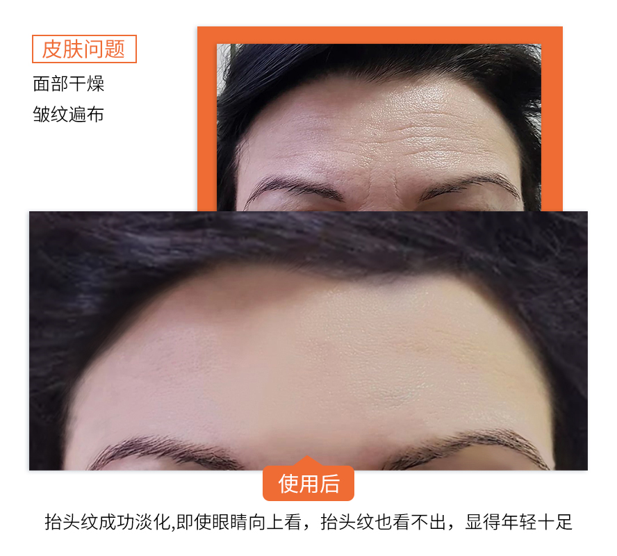|曝光！90后小伙在湖北出名了！把鲜花当面膜敷，皮肤白嫩得让女生受不了！