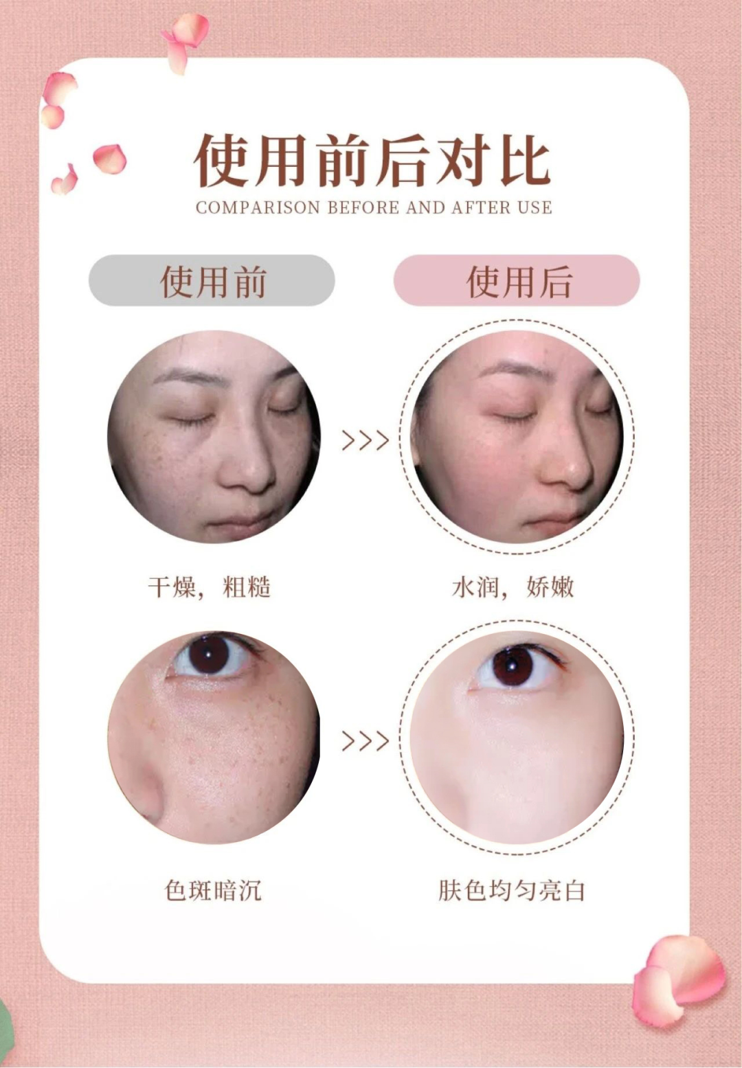 |曝光！90后小伙在湖北出名了！把鲜花当面膜敷，皮肤白嫩得让女生受不了！
