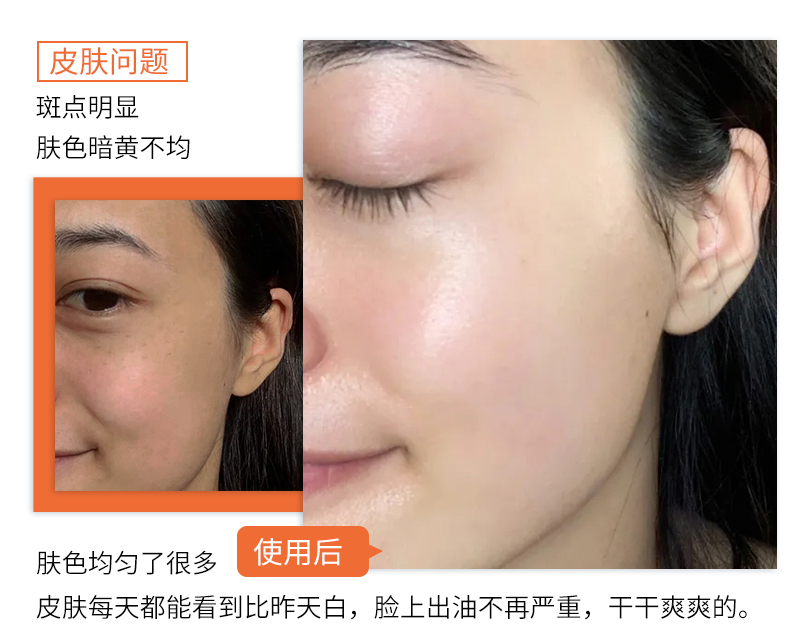 |曝光！90后小伙在湖北出名了！把鲜花当面膜敷，皮肤白嫩得让女生受不了！