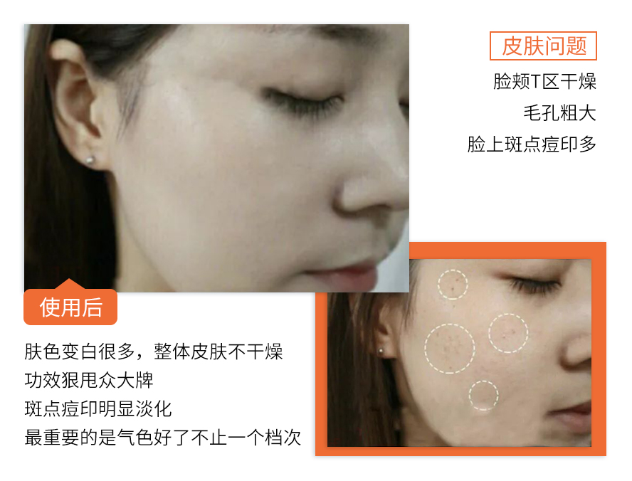 |曝光！90后小伙在湖北出名了！把鲜花当面膜敷，皮肤白嫩得让女生受不了！