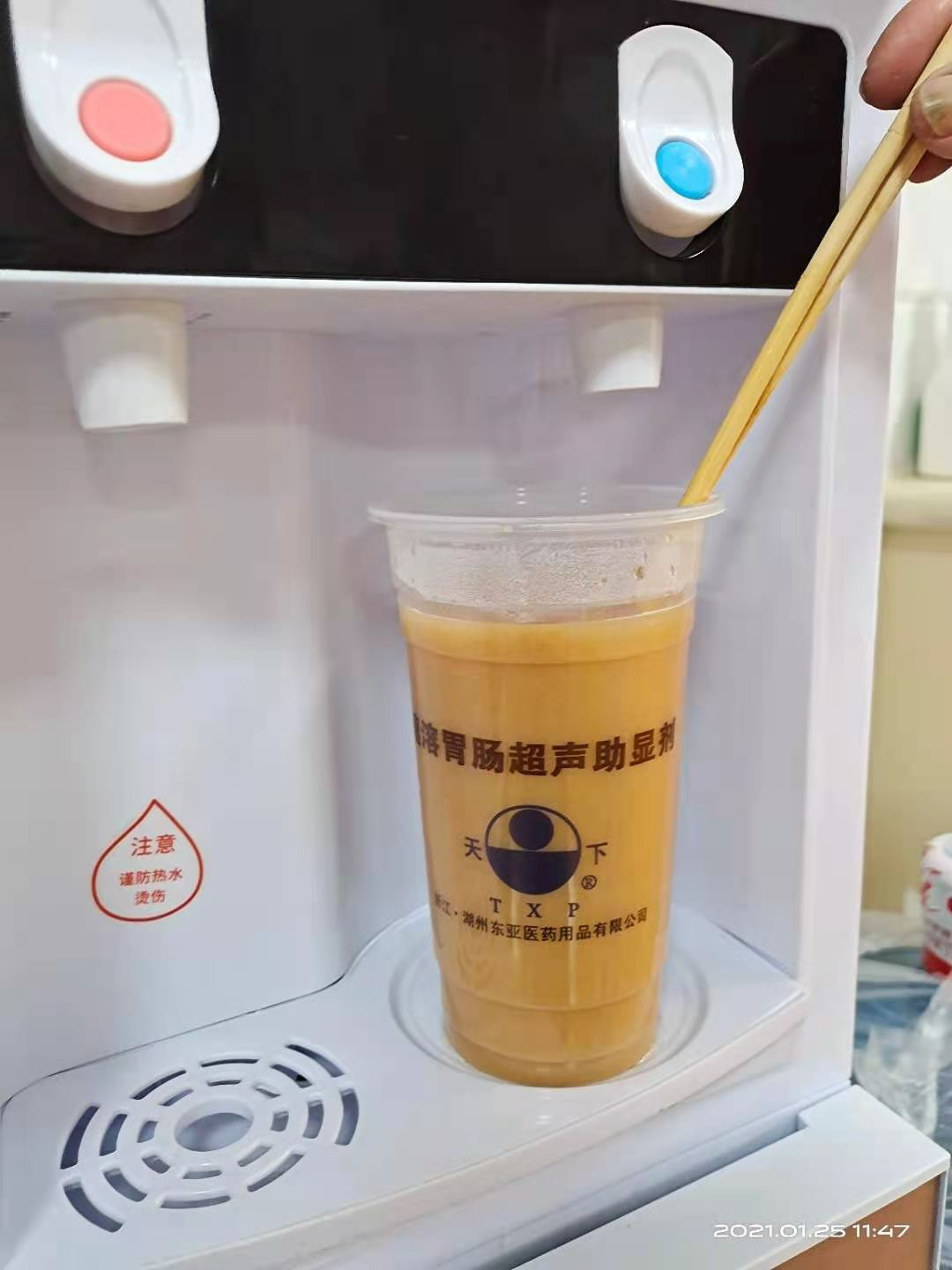 胃造影用的是什么机子超声诊断科新技术｜胃肠超声造影检查，让您舒舒服服做完肠胃筛查！_https://www.jmylbn.com_新闻资讯_第4张