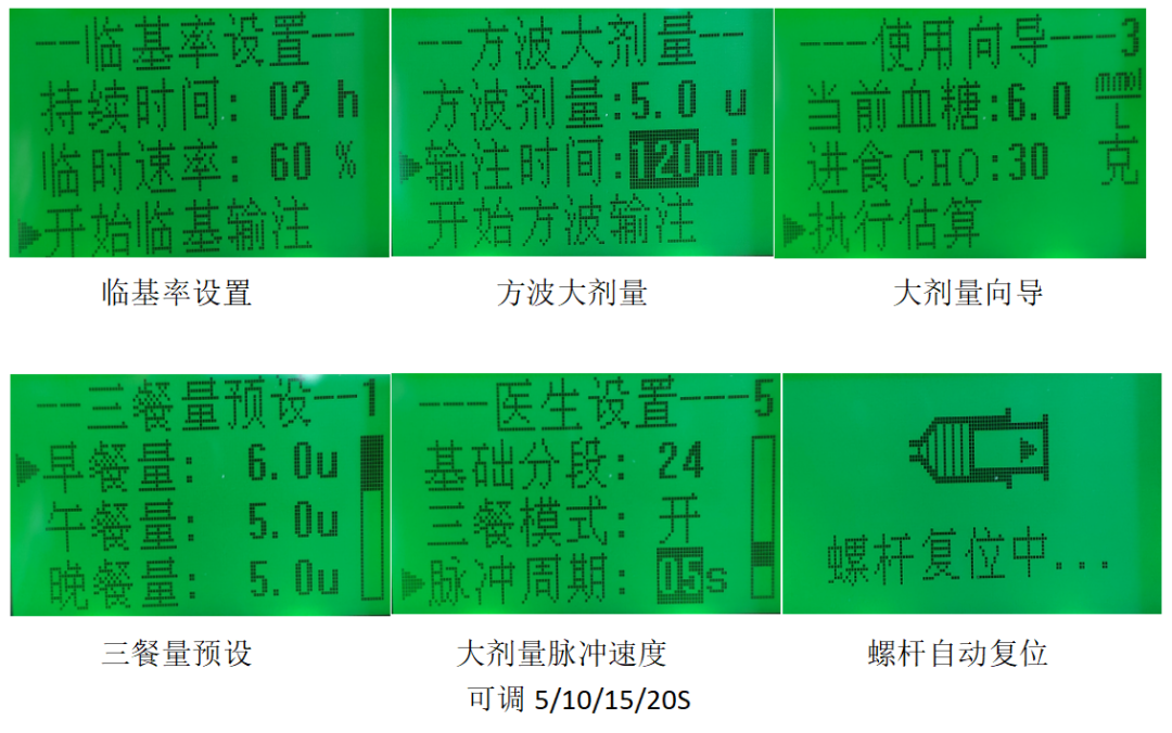 为什么要用泵打针告别传统注射方式，胰岛素泵为糖尿病管理带来智能化守护_https://www.jmylbn.com_新闻资讯_第5张