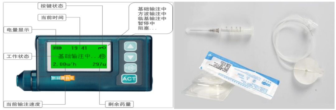 为什么要用泵打针告别传统注射方式，胰岛素泵为糖尿病管理带来智能化守护_https://www.jmylbn.com_新闻资讯_第3张