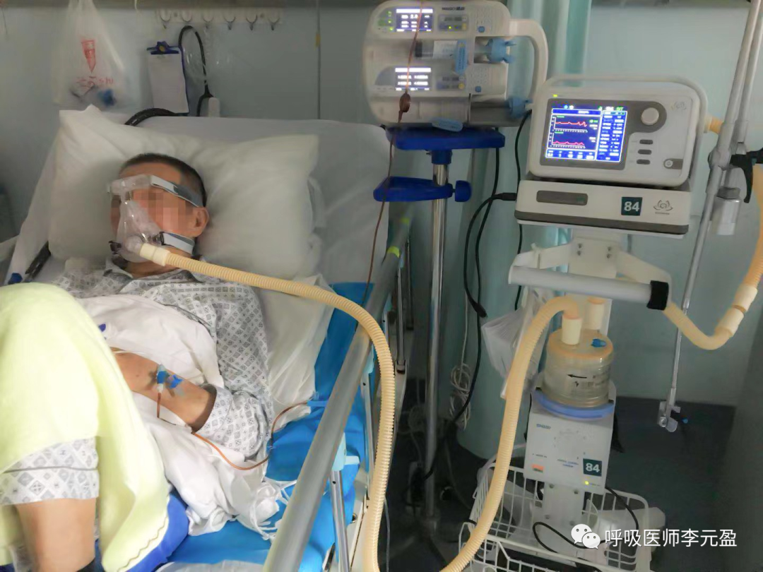 有创呼吸机是什么呼吸重症监护病房（RICU）关于无创还是有创呼吸机使用，你了解多少？_https://www.jmylbn.com_新闻资讯_第2张