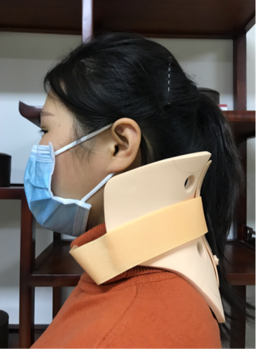 医用颈托怎么戴颈椎不好，到底要不要戴“颈托”？怎么戴？看这篇就够了！_https://www.jmylbn.com_新闻资讯_第6张