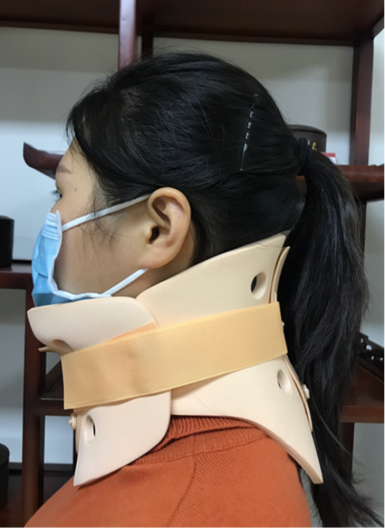 医用颈托怎么戴颈椎不好，到底要不要戴“颈托”？怎么戴？看这篇就够了！_https://www.jmylbn.com_新闻资讯_第7张