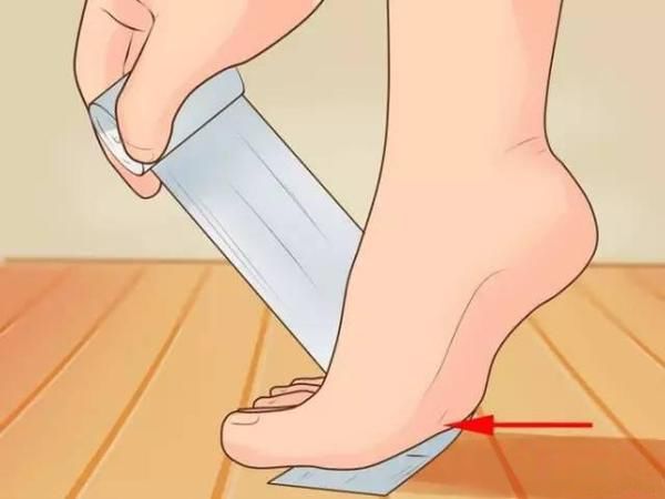 弹力绷带怎么固定运动损伤  ｜  关于弹力绷带的常识_https://www.jmylbn.com_新闻资讯_第3张