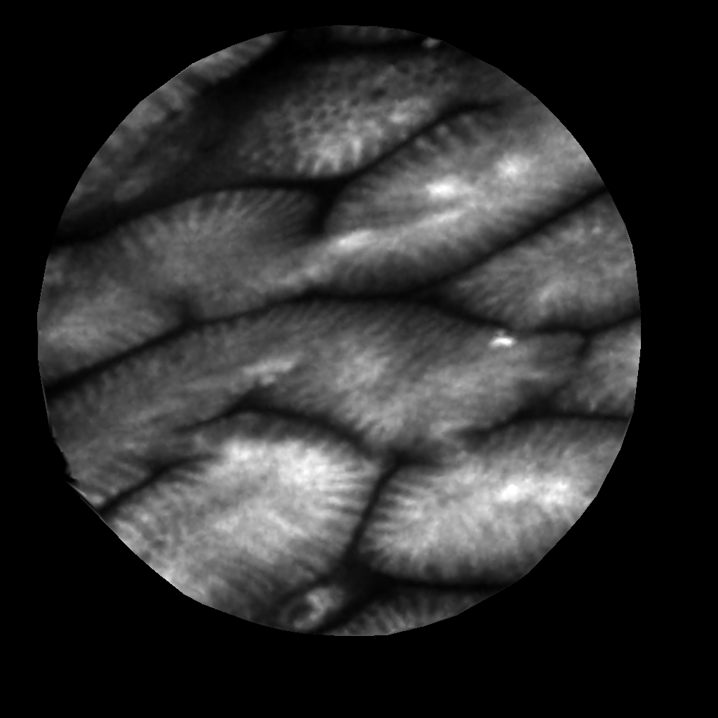 clearvue是什么独墅SHOW ｜  光学诊断新势力，攻破顶尖“扫癌利器”_https://www.jmylbn.com_新闻资讯_第9张